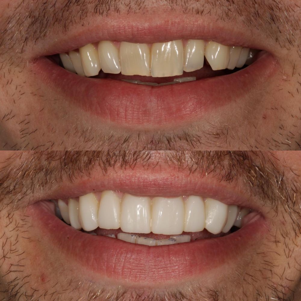 Before and after treatment at St Andrews Dental Care in Fife