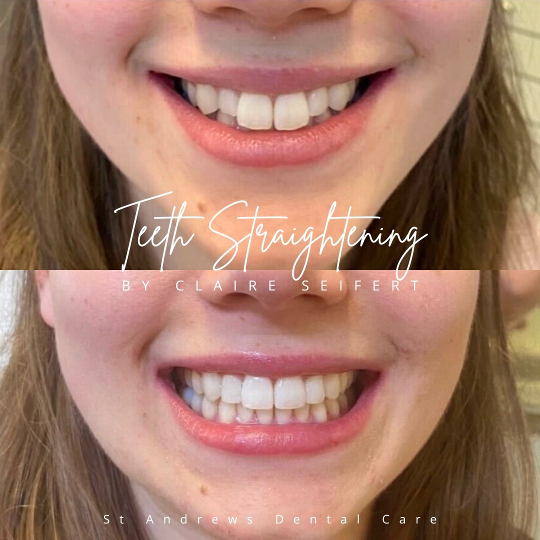 Smile Design in St Andrews