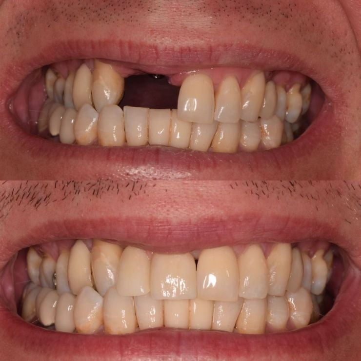 Transforming Smiles