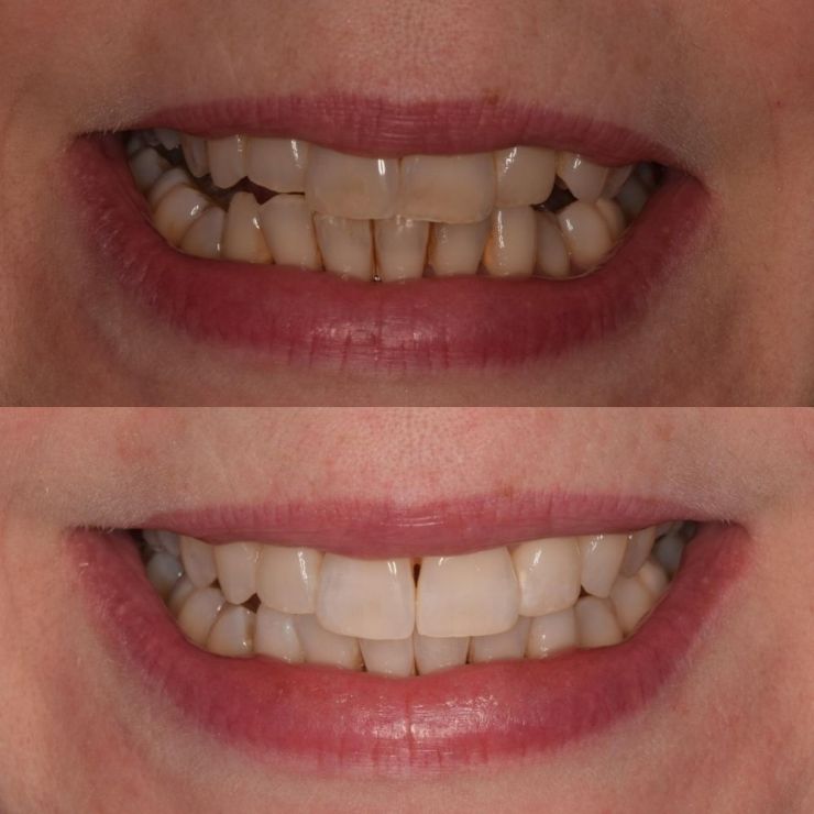 Transforming Smiles