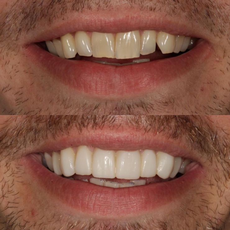 Transforming Smiles