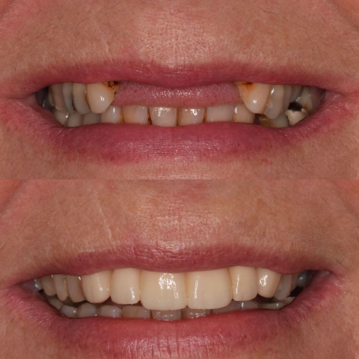 Transforming Smiles