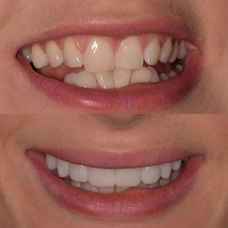 Transforming Smiles