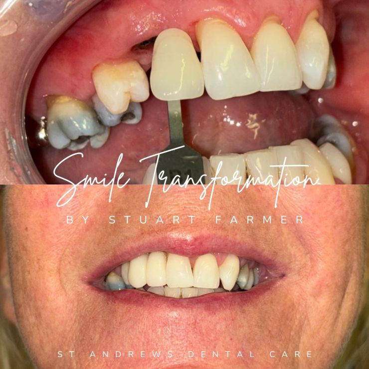 Transforming Smiles