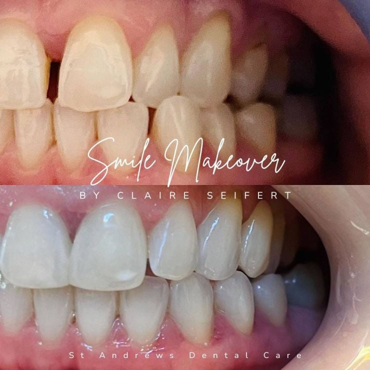 Transforming Smiles