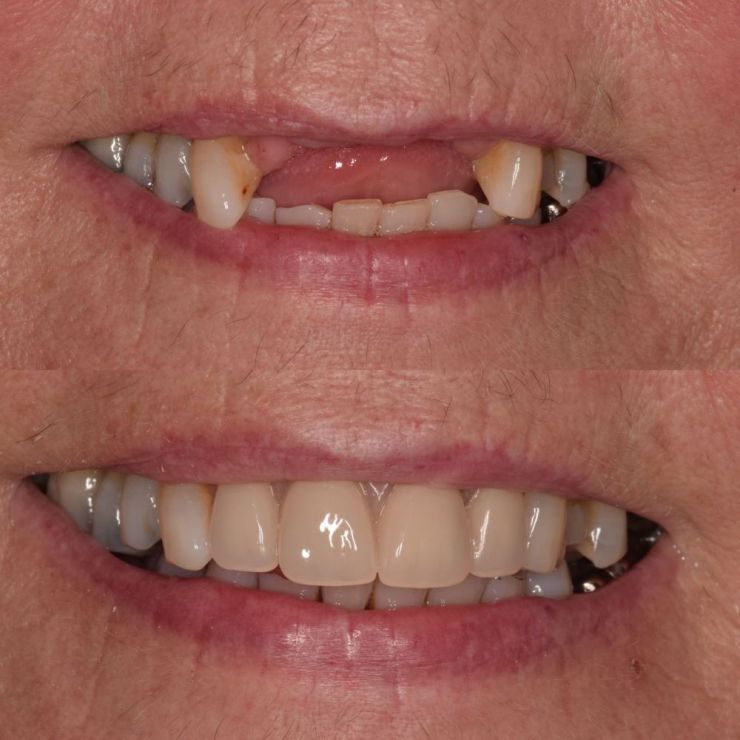 Transforming Smiles
