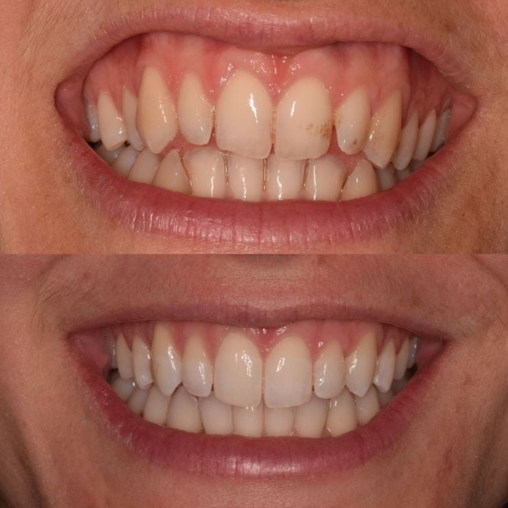 Transforming Smiles