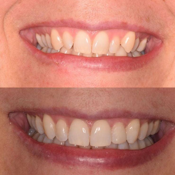 Transforming Smiles